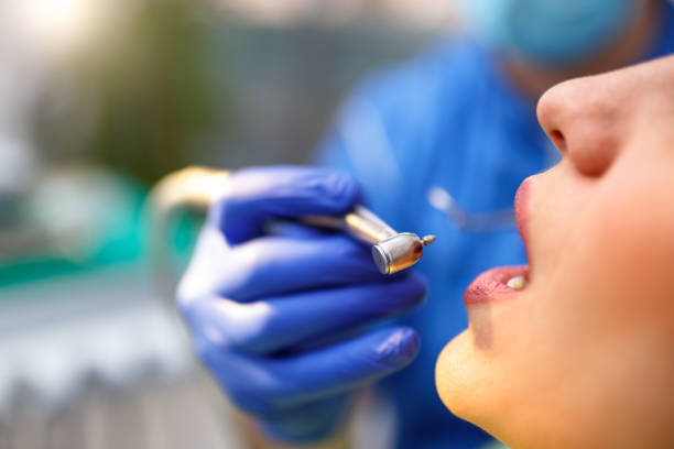 Dental Inlays and Onlays in Veedersburg, IN